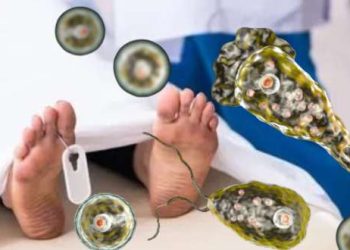 کراچی میں نیگلیریا فولیری سے متاثرہ نوجوان جاں بحق