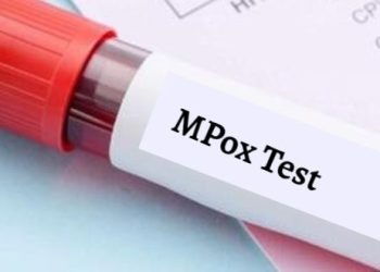 پاکستان میں منکی پاکس سے موت کا پہلا کیس سامنے آگیا